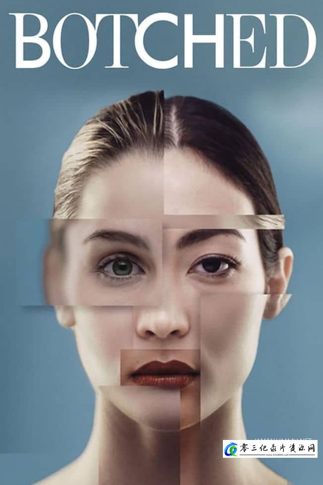 健康&医学纪录片《拯救失败整形术 Botched》下载-零三纪录片资源网