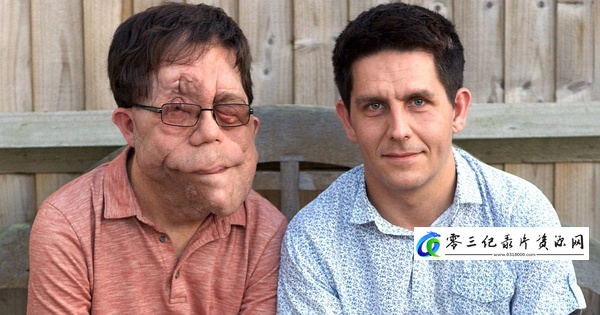 我的神奇双胞胎 My Amazing Twin的海报