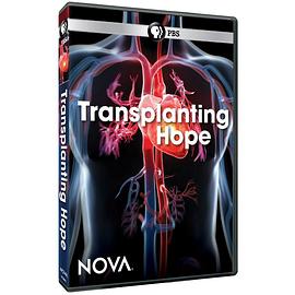 新星:移植希望 PBS Nova Transplanting HOPE的海报