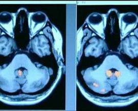 科学纪录片《地平线系列：记忆的实现 Horizon: How Does Your Memory Work?》下载-零三纪录片资源网
